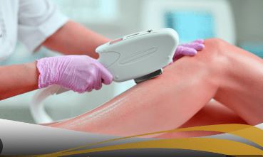 لیزر موهای زائد