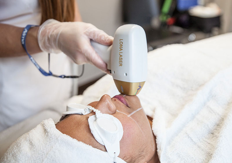 لیفتینگ صورت